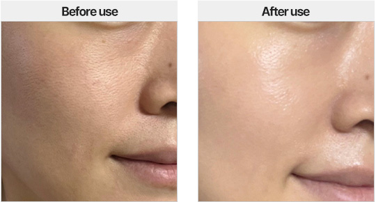 Skin Glow Improvement / Before use / After 1 day