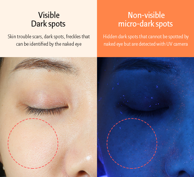 key points image 0